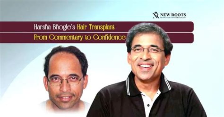 Harsha Bhogle Height, Age, Family, Facts, Biography